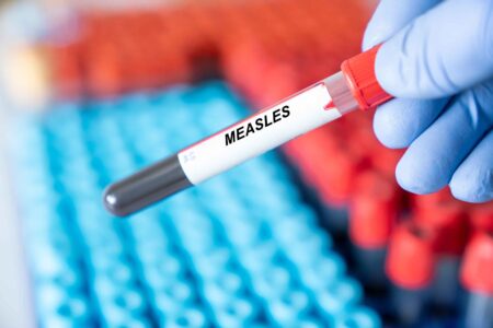 Confirmed Case Of Measles In Kaneland High School Has Health Officials On Alert